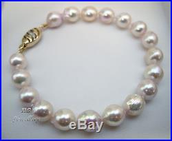 HS Baroque Japanese Akoya Pearl 9X10mm 14K with Diamonds Bracelet & Necklace Set